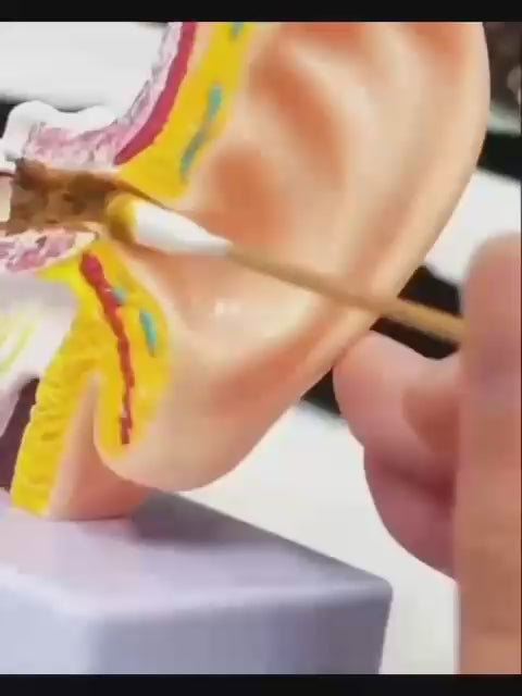 Kit de nettoyage d'oreilles