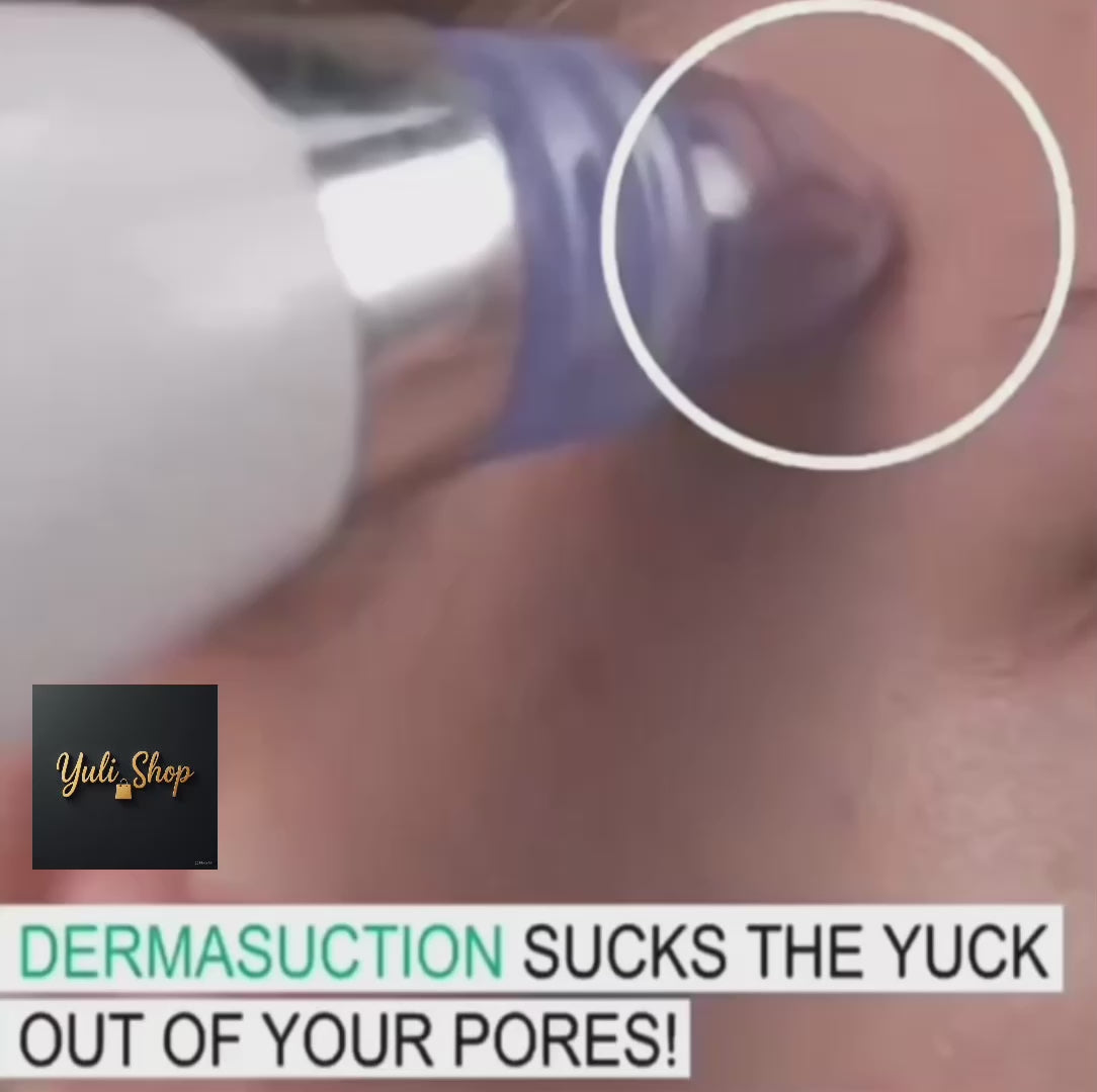 Aspirateur à électrons pour l'élimination des boutons d'acné